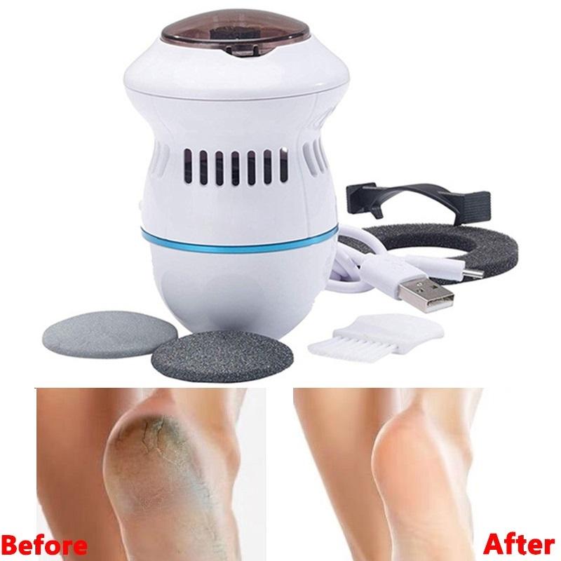 Пила за пети Pedi Vac